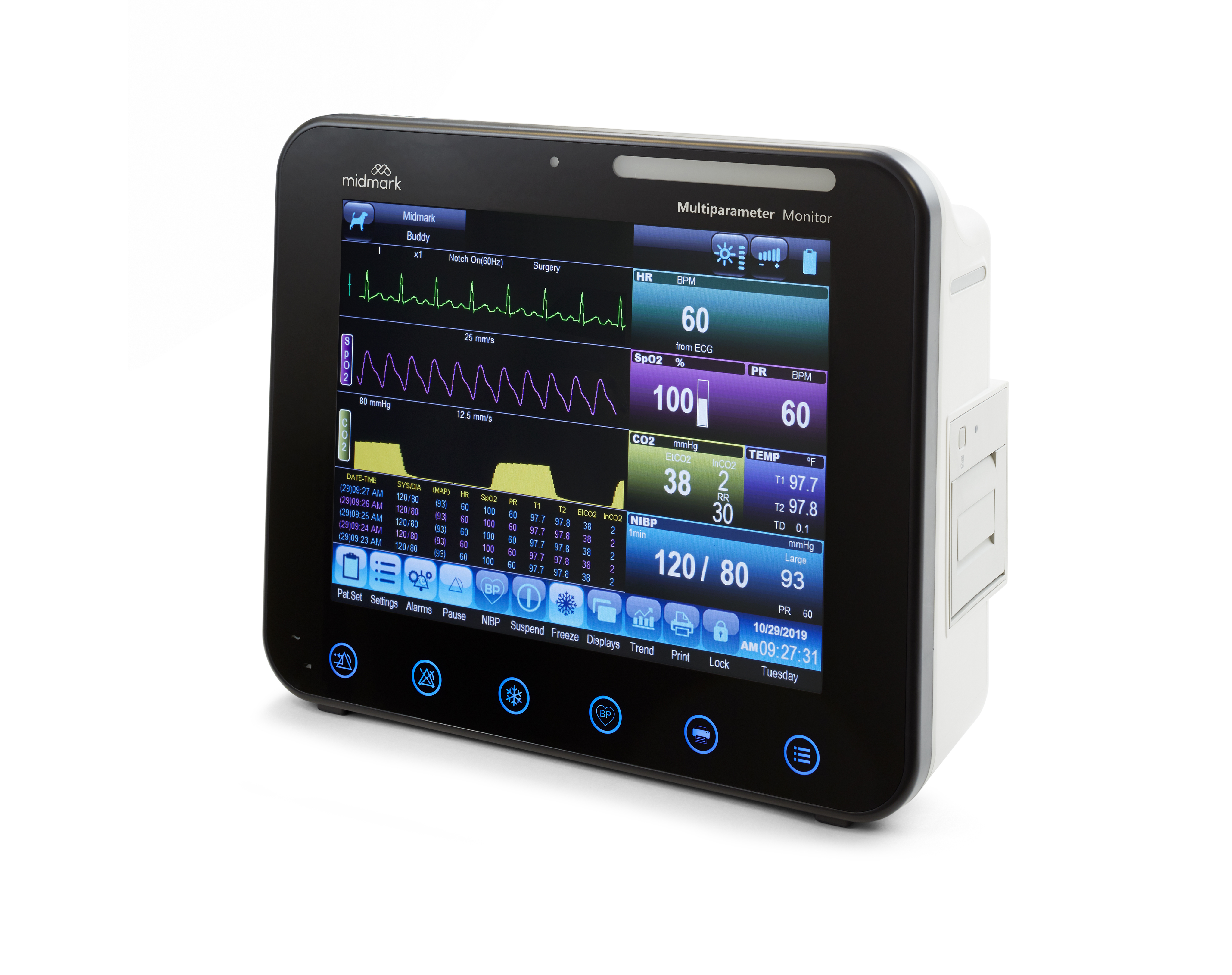 Using Capnography - Multiparameter Monitor