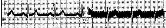 ACinterference05 ACinterference05